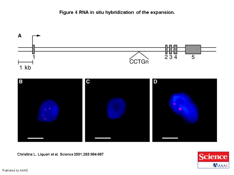 Figure 4 RNA in situ hybridization of the expansion.  Christina L. Liquori et